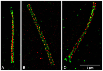 sted-cilia2.jpg